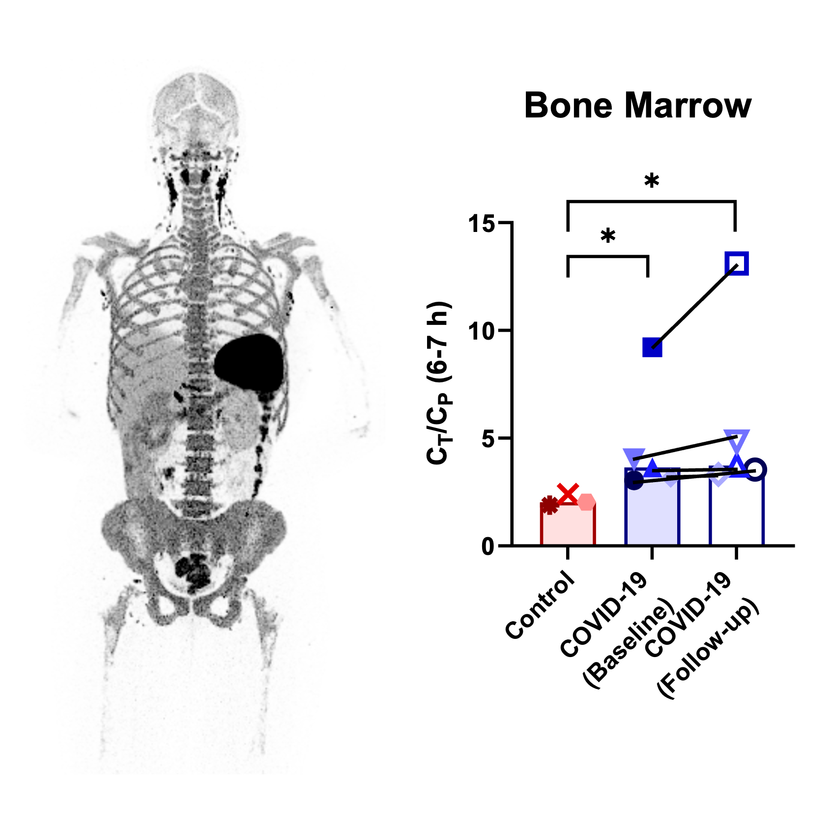 Total-body dynamic PET with a CD8-targeted minibody suggests increased CD8 density in bone marrow after COVID-19 infection.